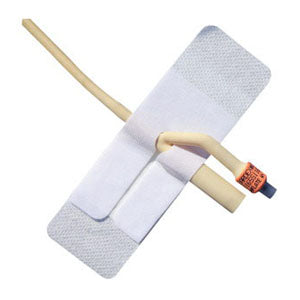 Adhesive Foley Catheter Anchoring Device 1 (EA)