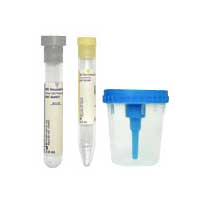 BD Vacutainer Urine Collection Kit with Screw-Cap Cup 50 (CA)