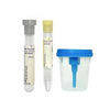 BD Vacutainer Urine Collection Kit with Screw-Cap Cup 50 (CA)