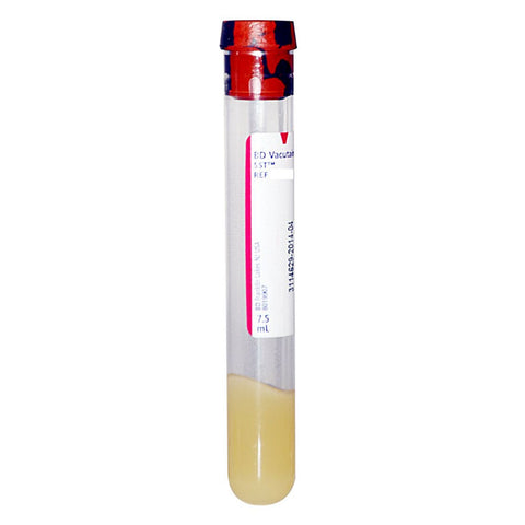 Vacutainer Plus Plastic Serum Tube with Red/Gray Conventional Closure, 8-1/2 mL, 16 mm x 100 mm 100 (BX)