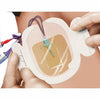 Tegaderm CHG Chlorhexidine Gluconate IV Securement Dressing 3-1/2